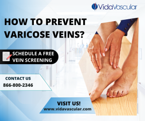 Varicose Veins Treatment