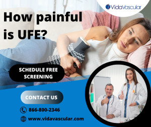 UFE AT VIDAVASCULAR