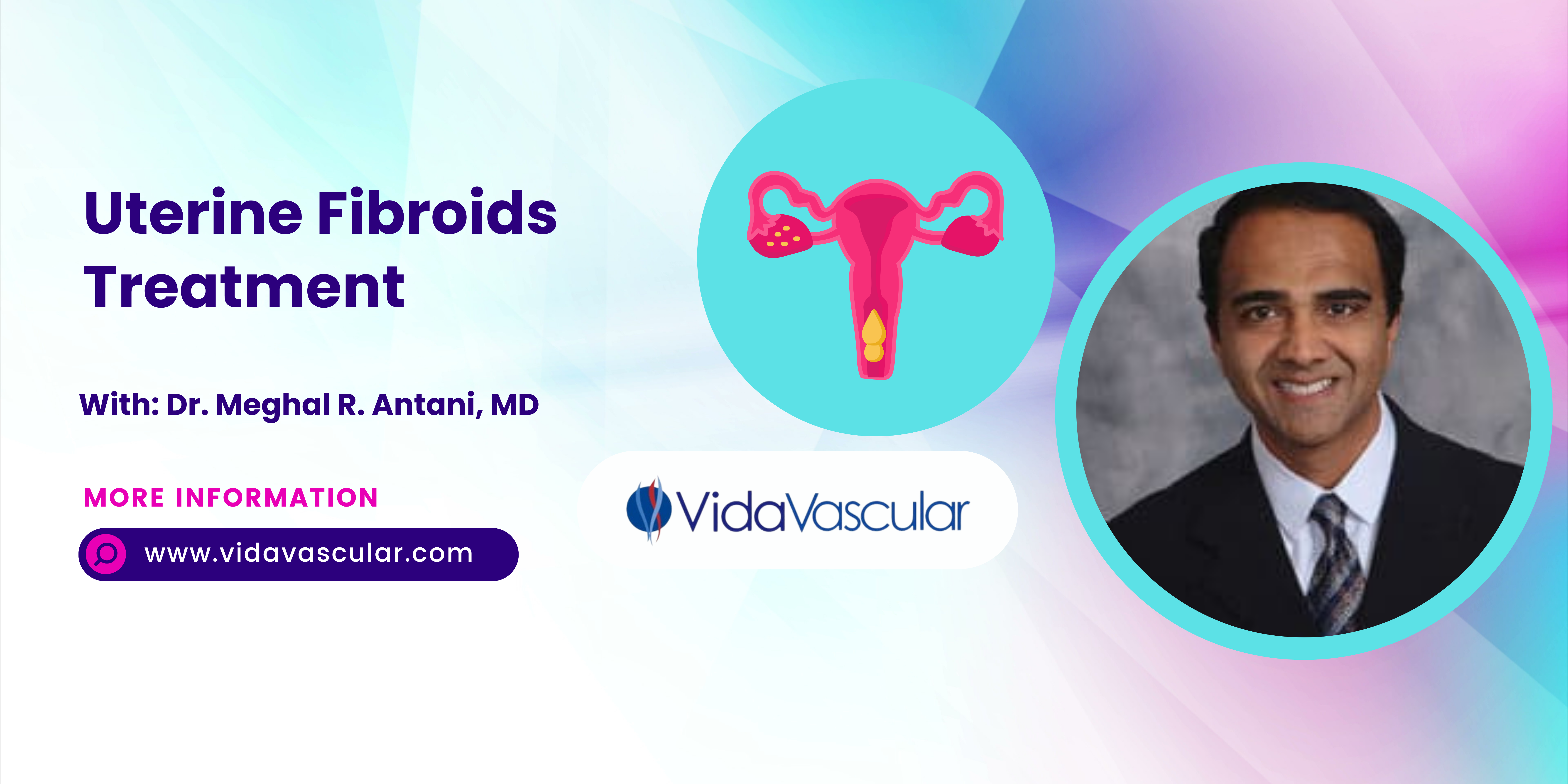 The Minimally Invasive Procedure To Treat Uterine Fibroids