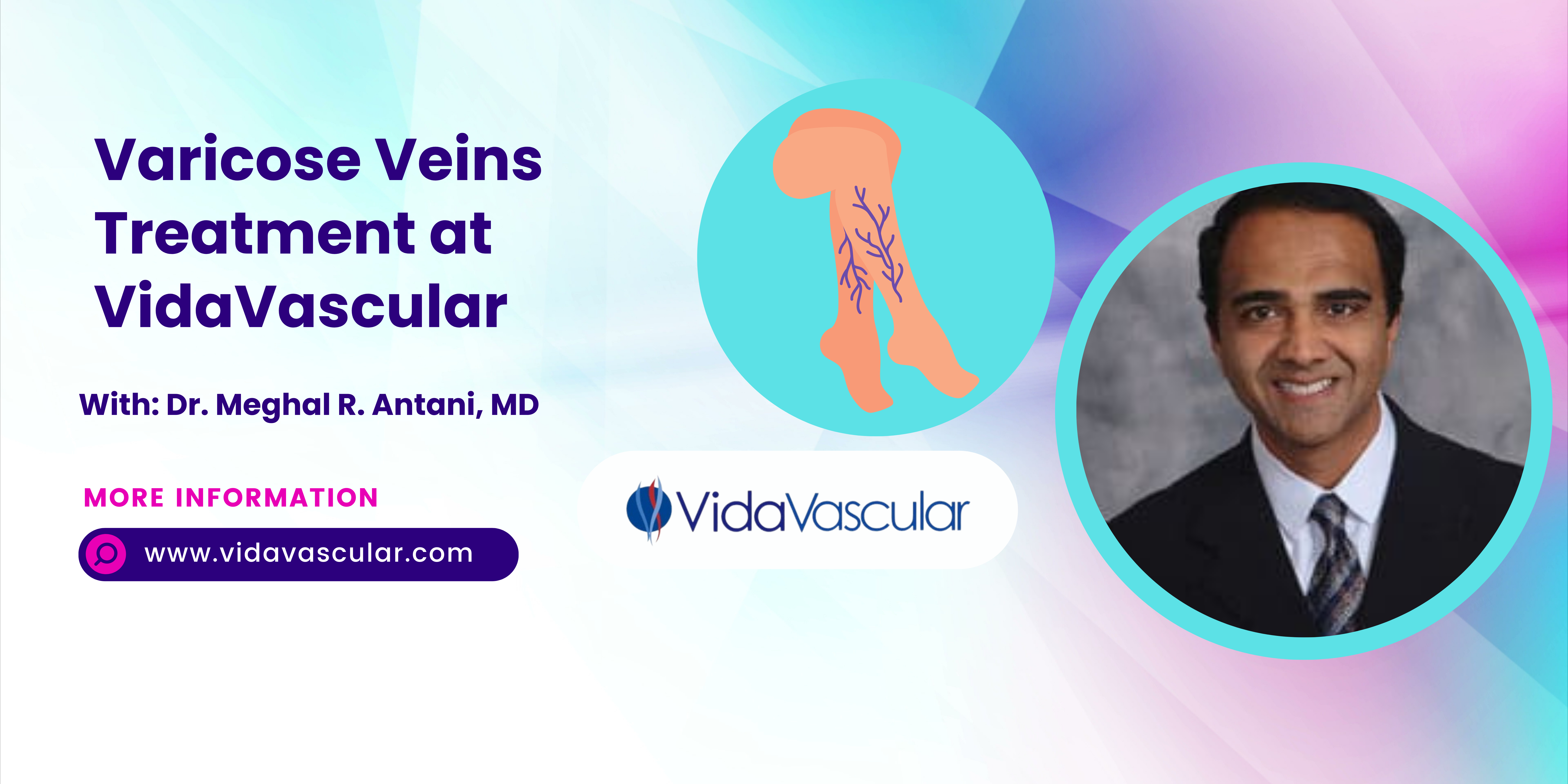 Are You Searching For The Best Varicose Veins Treatment In National Harbor?