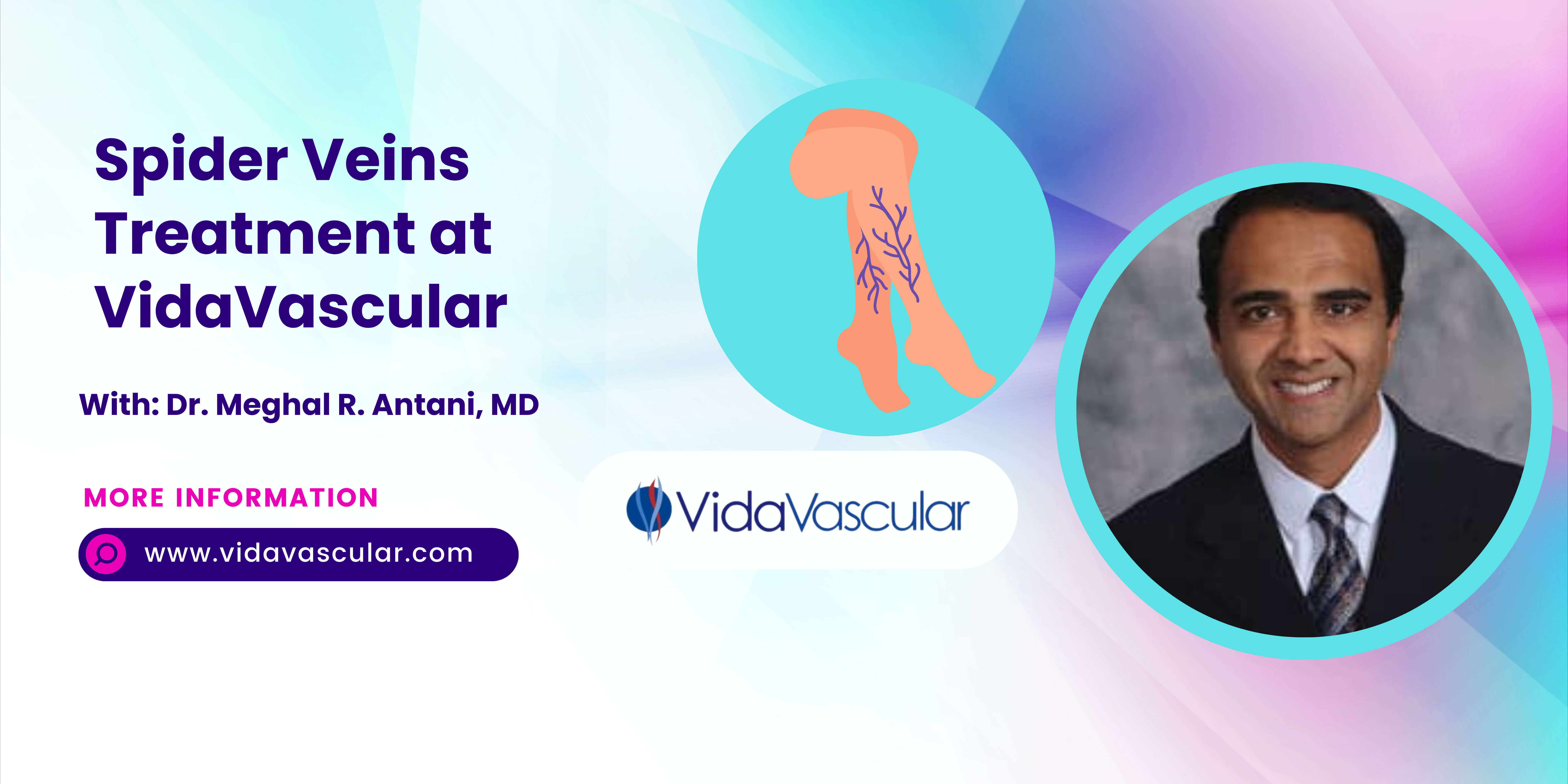 What Happens If Spider Veins Are Left Untreated?